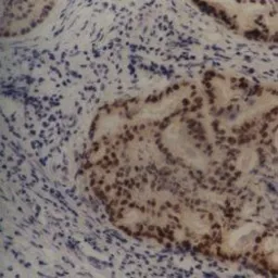 Anti-MDM2 antibody [SMP14] used in IHC (Paraffin sections) (IHC-P). GTX70278