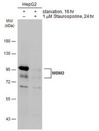 Anti-MDM2 antibody [SMP14] used in Western Blot (WB). GTX70278