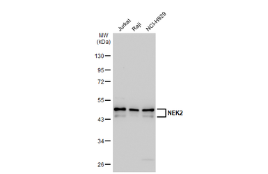 Anti-NEK2 antibody [1B6] used in Western Blot (WB). GTX70281