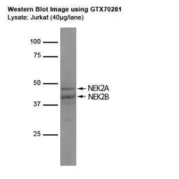 Anti-NEK2 antibody [1B6] used in Western Blot (WB). GTX70281