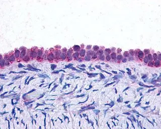 Anti-C/EBP beta antibody [21A1] used in Immunohistochemistry (IHC). GTX70283