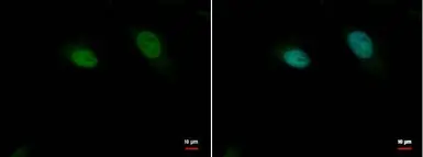 Anti-p37 antibody used in Immunocytochemistry/ Immunofluorescence (ICC/IF). GTX70287