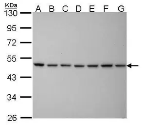 Anti-PSMC5 antibody [25D5] used in Western Blot (WB). GTX70288