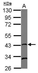 Anti-Rad51 antibody [13E4] used in Western Blot (WB). GTX70296
