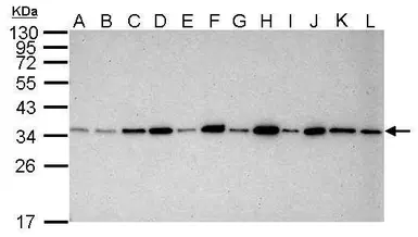 Anti-PCNA antibody [339] used in Western Blot (WB). GTX70298