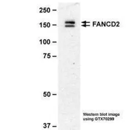 Anti-FANCD2 antibody [103] used in Western Blot (WB). GTX70299