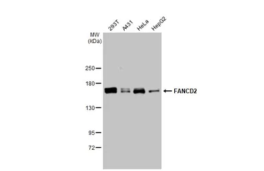 Anti-FANCD2 antibody [103] used in Western Blot (WB). GTX70299