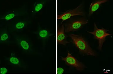 Anti-FANCD2 antibody [103] used in Immunocytochemistry/ Immunofluorescence (ICC/IF). GTX70299