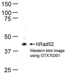 Anti-Rad52 antibody [5H9] used in Western Blot (WB). GTX70301