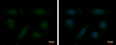 Anti-TRF1 antibody [4E4] used in Immunocytochemistry/ Immunofluorescence (ICC/IF). GTX70304