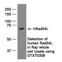 Anti-RAD54L antibody [60.1] used in Western Blot (WB). GTX70306