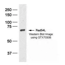 Anti-RAD54L antibody [60.1] used in Western Blot (WB). GTX70306