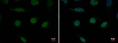 Anti-XPB antibody used in Immunocytochemistry/ Immunofluorescence (ICC/IF). GTX70311