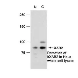 Anti-XAB2 antibody used in Western Blot (WB). GTX70312