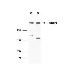 Anti-53BP1 antibody used in Western Blot (WB). GTX70316