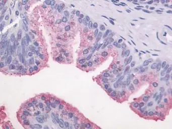 Anti-Hepatitis E virus antibody used in Immunohistochemistry (IHC). GTX70319