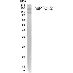 Anti-PTCH2 antibody used in Western Blot (WB). GTX70350