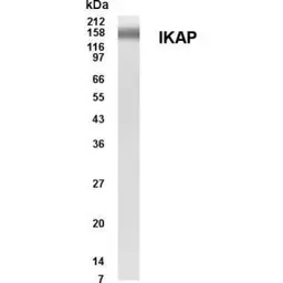 Anti-IKAP antibody used in Western Blot (WB). GTX70365