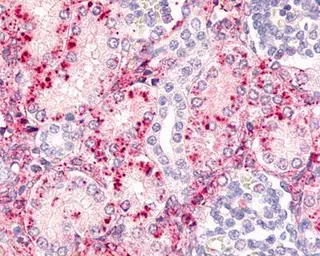 Anti-NKIAMRE antibody used in Immunohistochemistry (IHC). GTX70373