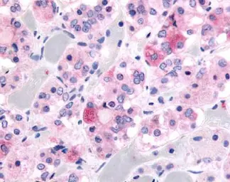 Anti-Kallikrein 9 antibody used in Immunohistochemistry (IHC). GTX70427