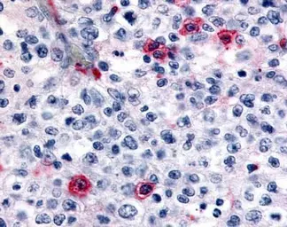 Anti-FANCJ antibody used in Immunohistochemistry (IHC). GTX70433