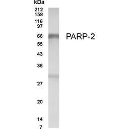 Anti-PARP2 antibody used in Western Blot (WB). GTX70456