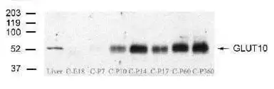 Anti-GLUT10 antibody used in Western Blot (WB). GTX70487