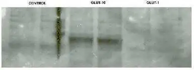 Anti-GLUT10 antibody used in Western Blot (WB). GTX70487