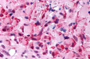 Anti-5-HT2B receptor antibody used in IHC (Paraffin sections) (IHC-P). GTX70497