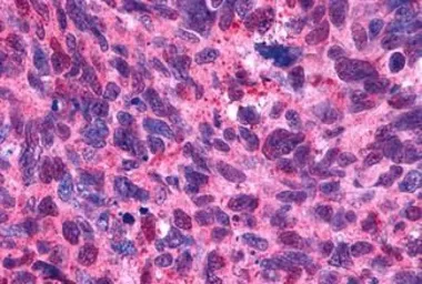 Anti-5-HT2B receptor antibody used in IHC (Paraffin sections) (IHC-P). GTX70497