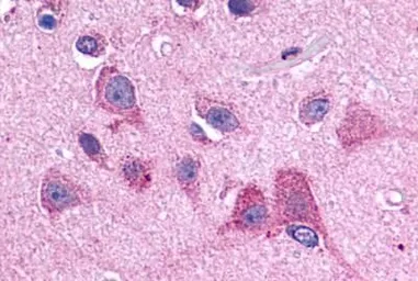 Anti-5-HT2B receptor antibody used in IHC (Paraffin sections) (IHC-P). GTX70497
