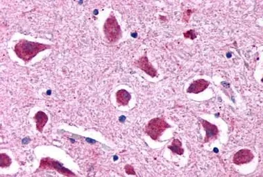Anti-5-HT2B receptor antibody used in IHC (Paraffin sections) (IHC-P). GTX70497