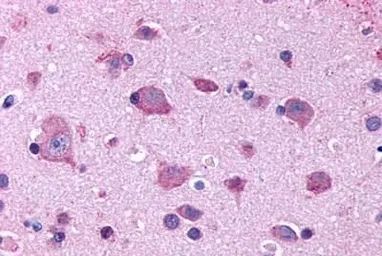 Anti-5-HT2B receptor antibody used in IHC (Paraffin sections) (IHC-P). GTX70497