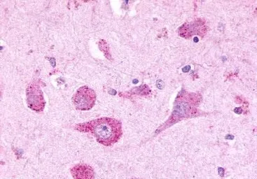 Anti-Latrophilin 3 antibody used in IHC (Paraffin sections) (IHC-P). GTX70499