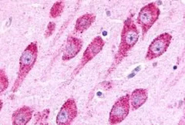 Anti-Latrophilin 3 antibody used in IHC (Paraffin sections) (IHC-P). GTX70499