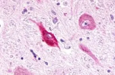 Anti-Latrophilin 3 antibody used in IHC (Paraffin sections) (IHC-P). GTX70499