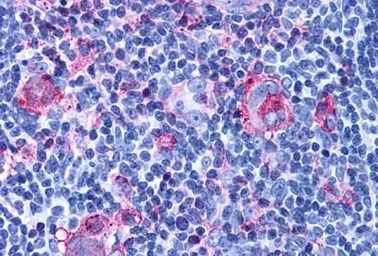 Anti-CXCR3 antibody used in IHC (Paraffin sections) (IHC-P). GTX70527