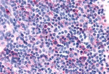 Anti-CXCR3 antibody used in IHC (Paraffin sections) (IHC-P). GTX70527