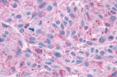 Anti-CXCR3 antibody used in IHC (Paraffin sections) (IHC-P). GTX70527
