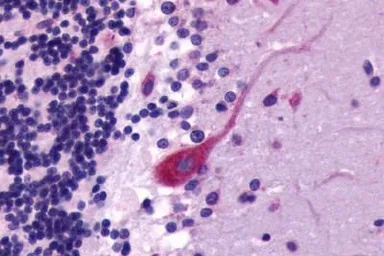 Anti-CXCR4 antibody used in IHC (Paraffin sections) (IHC-P). GTX70531