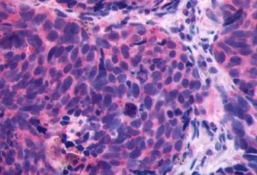 Anti-CXCR4 antibody used in IHC (Paraffin sections) (IHC-P). GTX70531