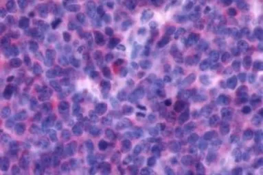 Anti-CXCR4 antibody used in IHC (Paraffin sections) (IHC-P). GTX70531