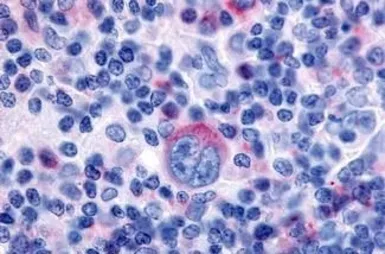 Anti-GPR65 antibody used in IHC (Paraffin sections) (IHC-P). GTX70559