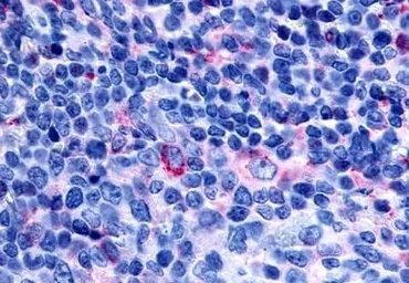 Anti-GPR65 antibody used in IHC (Paraffin sections) (IHC-P). GTX70559