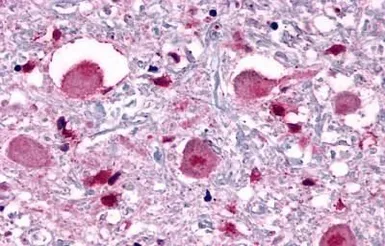 Anti-Opsin 3 antibody used in IHC (Paraffin sections) (IHC-P). GTX70607