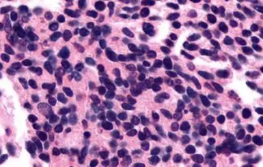 Anti-Opsin 3 antibody used in IHC (Paraffin sections) (IHC-P). GTX70607