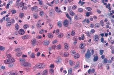 Anti-GPRC5C antibody used in IHC (Paraffin sections) (IHC-P). GTX70675