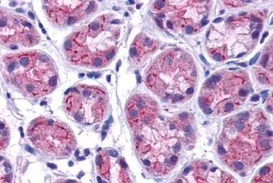 Anti-GPRC5C antibody used in IHC (Paraffin sections) (IHC-P). GTX70675
