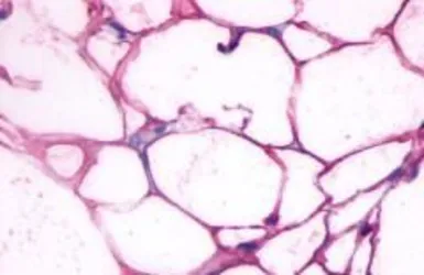 Anti-beta 3 Adrenergic Receptor antibody used in IHC (Paraffin sections) (IHC-P). GTX70685