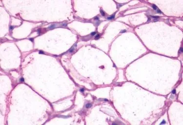 Anti-beta 3 Adrenergic Receptor antibody used in IHC (Paraffin sections) (IHC-P). GTX70685